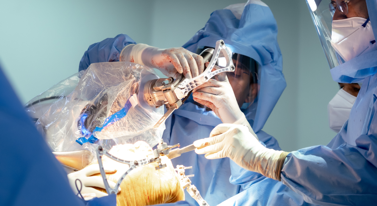 driving-after-knee-replacement-recovery-timeline